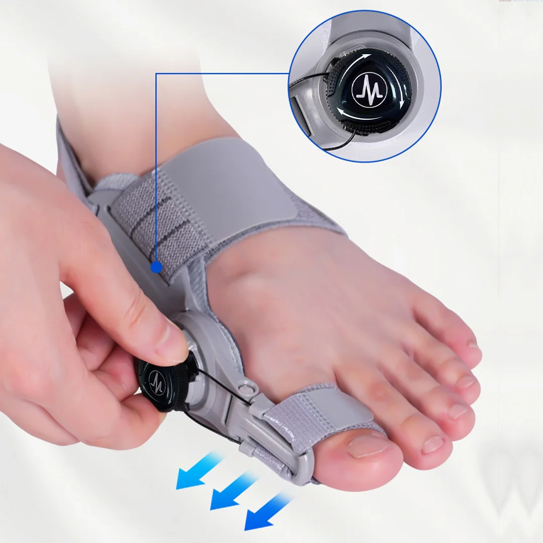 Adjustable bunion fix close up